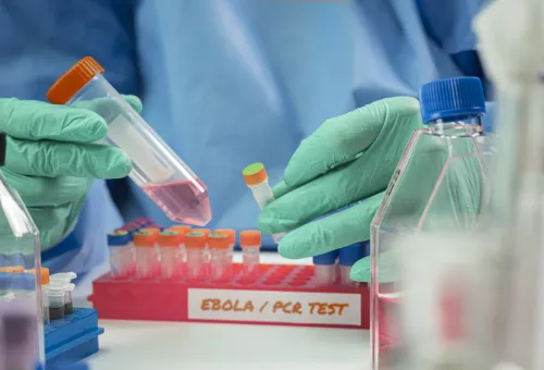 A scientist examines an Ebola virus PCR test in a laboratory stock photo