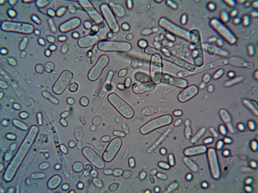 microbes on a petri dish